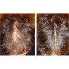 Sistema Novocrin Tratamiento Completo