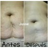 Jusse Kit Jusse Reafirma Reduce Talla Vientre Cintura Chaparreras
