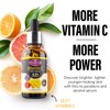 AICHUN BEAUTY 12.5% Vitamin C Face Serum Moisturizing Anti-Freckle Anti-Aging