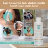 DHS Zinc Shampoo – Dandruff Shampoo – for Flaky and