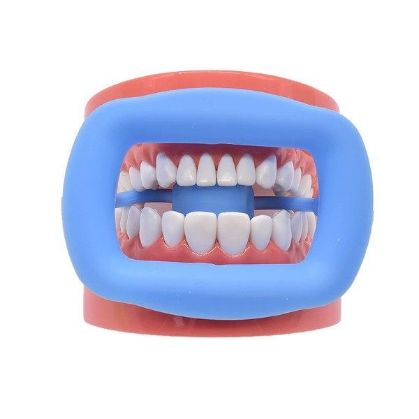 Dental Cheek Retractor Soft Silicone for Teeth Whitening Treating Mouth