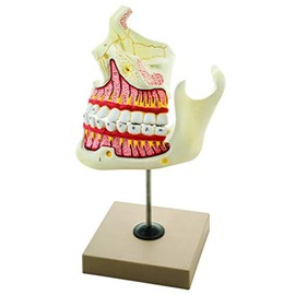 EISCO Upper and Lower Jaw Anatomical Model, 4X Enlarged, Dental Structure Educational Display