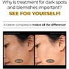 DEOPROCE DARK SPOT CLEAR CREAM 30ML