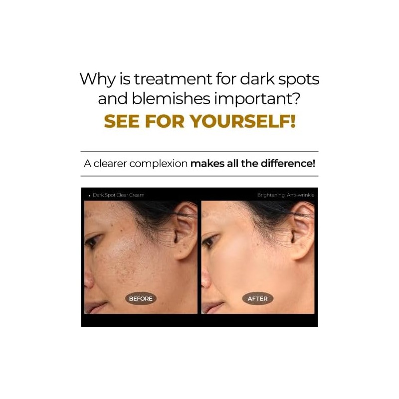 DEOPROCE DARK SPOT CLEAR CREAM 30ML