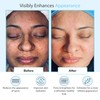 Glycolic Acid 50% Gel Peel - Enhanced with Retinol &