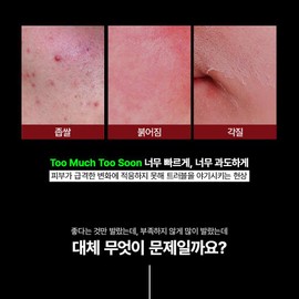Vincent Pandu ⭐Vincent Pandu full line tools⭐Amniotic Tea Kit (Ampoule A + Ampoule B + Cream 50ml) / ⭐뱅상판두 전라인 공구⭐암니오티키트(앰플A+앰플B+크림50ml)