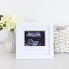 Pearhead Love At First Sight Sonogram Frame, Ultrasound Picture Frame,
