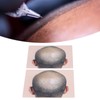 Man Bald Micropigmentattion Practice Skin Silicone Hairline Microblading Practice Pads