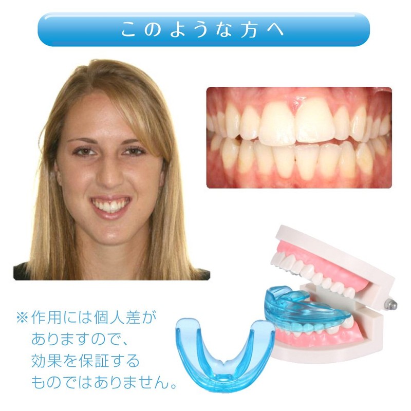 Grocia Slight Orthodontic Correction, Tooth Grinding, Mouthpiece, x1, G -