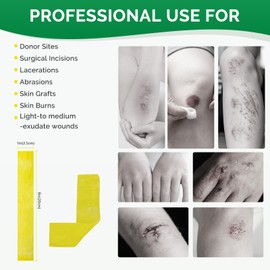 Greetmed Xeroform Petrolatum Dressing 1"x8" Fine Mesh Non Stick Gauze Pads for Wound Care, Sterile Non-Adherent Gauze Patch for Burns, Lacerations, Skin Graft, Sutured Wounds (Pack of 50)