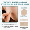 Epiderm Silicone Scar Circles – Medical Grade Silicone Scar Patches