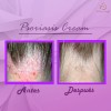 Set Crema Psoriasiscream Hidratante Aliviante & Jabón Psorel
