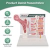Ultrassist Osteoporosis Model, Human Vertebrae Anatomical Model for Teaching Demonstration