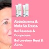 benevi Pigment Cream 20 ml for Targeted Covering Redness, Pimples,