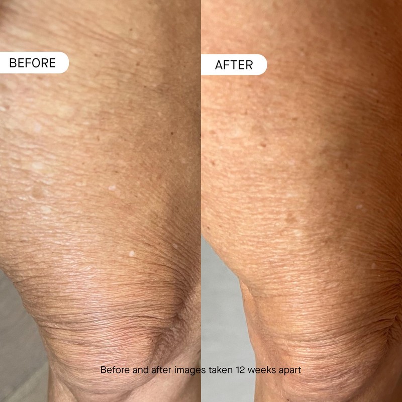 oneskin BODY OS-01 Peptide Topical Supplement & Skin Longevity Age