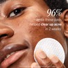 First Aid Beauty Acne Pads for Face - Maximum Strength