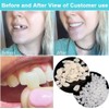 Fake Tooth Repair Kits DIY Dental Care Kit Glue for