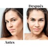 Kit Antiedad Y Rejuvenecedor Lilo Skincare Vitamina E