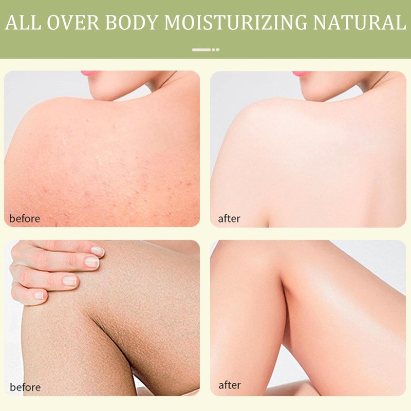 Tea Tree Cream, Soothing Tea Tree Oil Balm for Dry