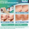 Professional Silicone Scar Sheets (1.6" x 150" Scar Roll-3.8M) -