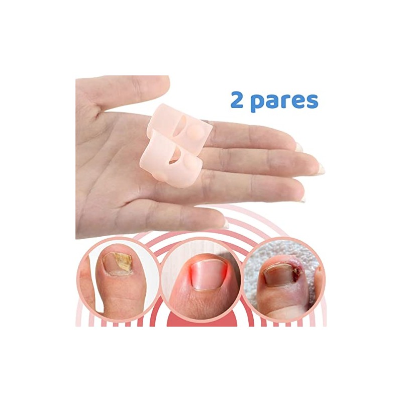 Set 2 Pares Protector Dedo Gordo Uñas Encarnadas Uñeros Alivia