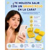 128 Estrellas para Granos, 4 Cajas de Parches para Acne
