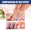 Nail Strengthener for Damaged Nails-Nail Growth Serum - Strengthener and