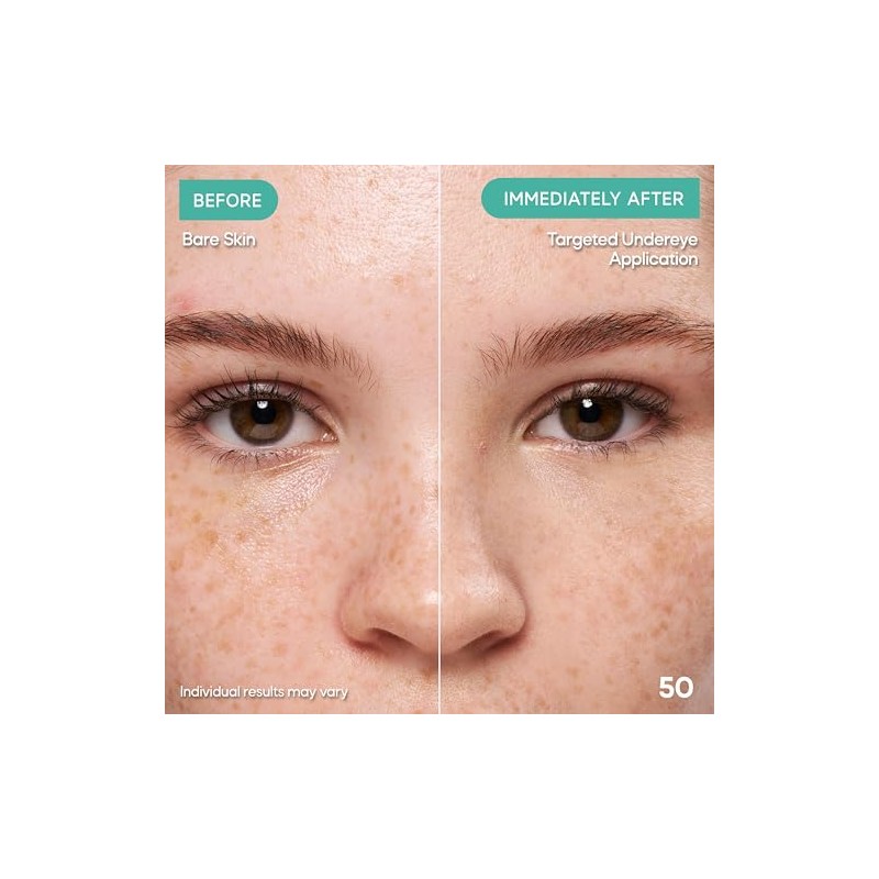 Corrector Almay Clear Complexion Tono
