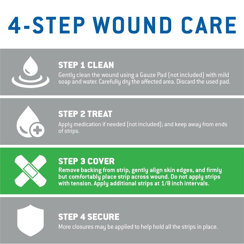 Care Science Adhesive Wound Closure Strips, 1/4 x 4 in,