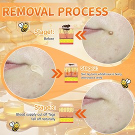 2 Stück Bienengift Hautregenerationscreme, Bienengiftsalbe, Bee Cream, Bee Cream Bienengiftsalbe, Bienengift Creme für alle Hauttypen (2)