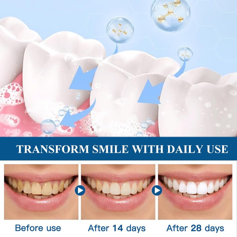 Toothpaste, tooth cleaning, relief for white teeth, natural whitening, toothpaste