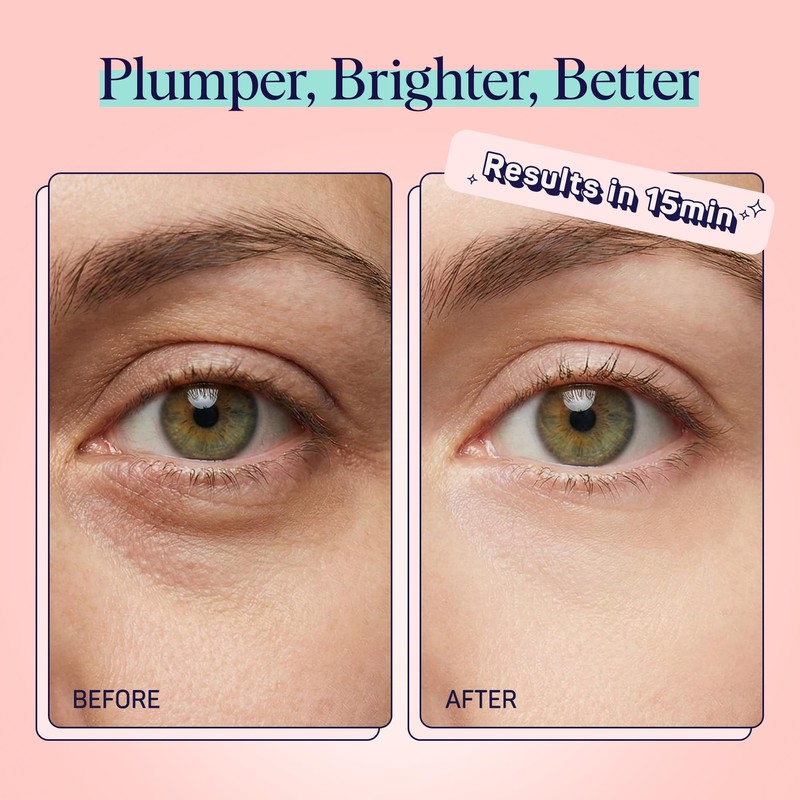 SpaLife Watermelon Cooling Eye Pads, 48 Hydrating Under Eye Patches