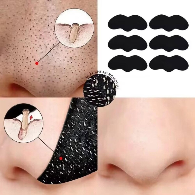 10 20 50 100PCS 블랙 도트 리무버 케어 마스크 스티커