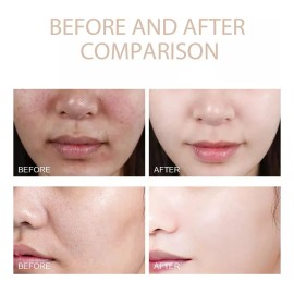 El Gel Exfoliante Ouhoe Limpia Suavemente Y Suaviza La Piel,