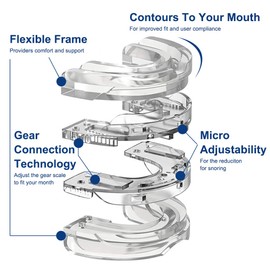 Schnarchstopper Schnarchschiene Anti-Schnarch, EUBSWA Schnarchen Frei Anti-Snoring Schiene Gegen Waschbar, Schnarch Snore Mouth Guard