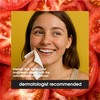 Yes To Tomatoes Clear Skin Acne Fighting Facial Wipes, Acne