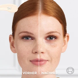 L'Oréal Paris Concealer for a Natural Radiant, Moisturising and Plumping, Face Makeup with Hyaluronic Acid and Caffeine, True Match Radiant Serum Concealer 1N, 11 ml