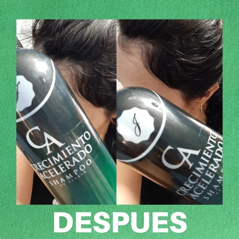 Shampoo Crecimiento Acelerado (2 Shampoo + 1 Mini)