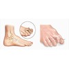 Hammer Toe Correctors