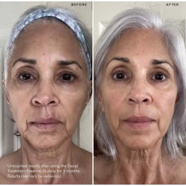 SK-II Facial Treatment Essence 75ml 2.5 Ounce Pitera Essentials Anti-aging Serum