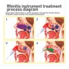 Beurha Laser Terapia Rinitis Alergias Adulto/niño Envio Gratis
