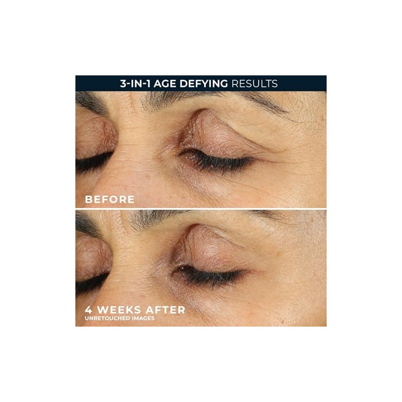 Roc Retinol Correxion Anti Aging Eye Cream Treatment Packaging May
