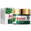 Oil Control Face Cream, Anti Acne Face Cream
