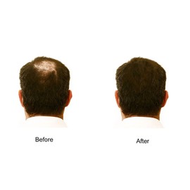 My Secret Hair Enhancer SILVER/GREY for thinning hair loss 5 oz, Two Pack