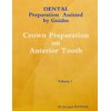 Dental Preparation Assisted By Guides Volume 1 Crown Preparation On