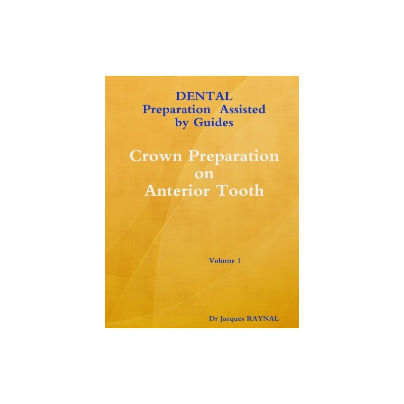 Dental Preparation Assisted By Guides Volume 1 Crown Preparation On