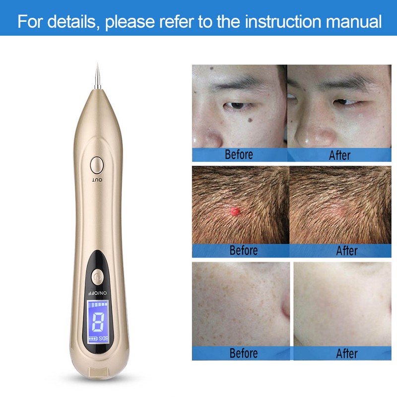 LCD Screen Spot Removal Pen USB Freckle Spot Mole Tattoo