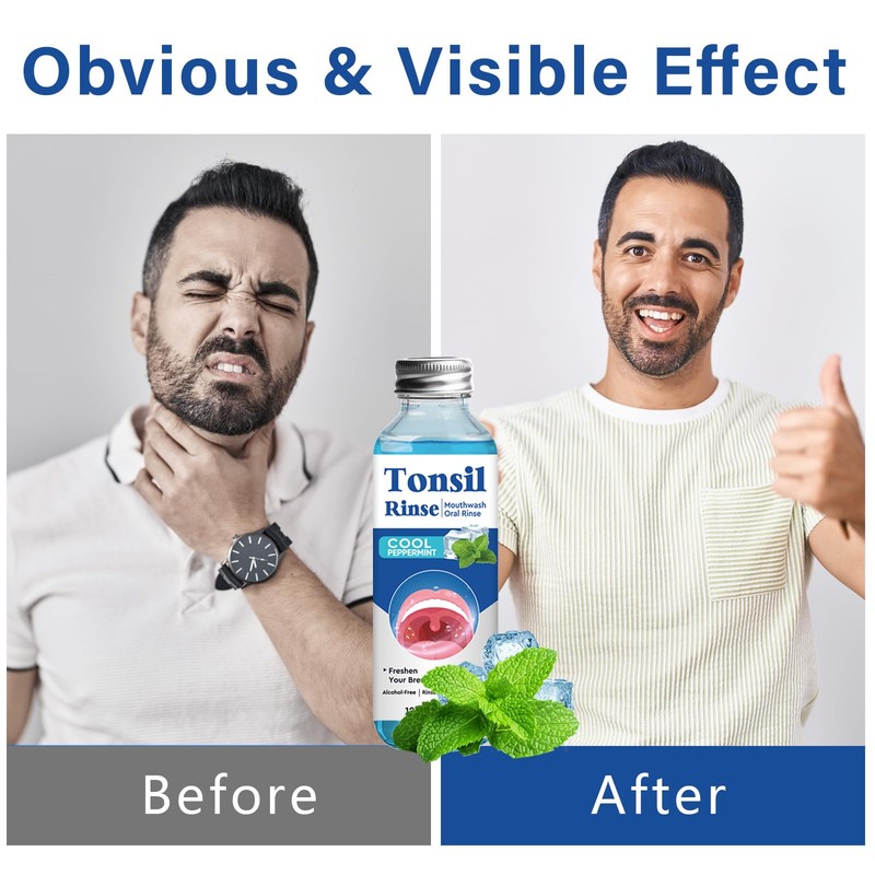 Tonsil Stone Remover, Tonsil Stone Care Mouthwash to Help Freshen