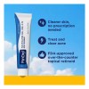 Panoxyl Crema Y Parches Para Acne 15g Adolescentes
