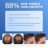 Bosley Professional Strength BOSRevive Nourishing Shampoo for Visibly Thinning Hair